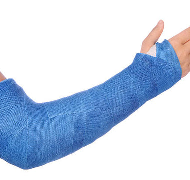 Playing Soccer with a Cast: What's Allowed and What's Not?